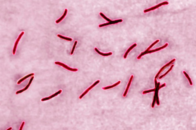 bakteri TBC