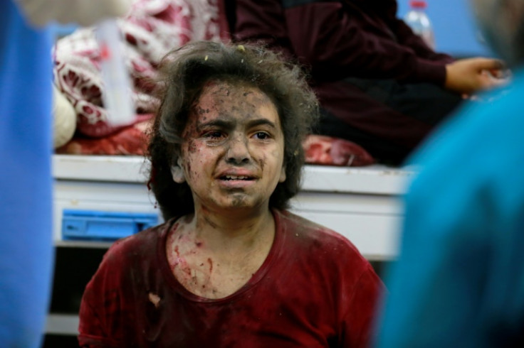 Seorang gadis muda yang terluka menunggu perawatan di bangsal darurat rumah sakit Al-Shifa setelah serangan Israel, di Kota Gaza pada 5 November 2023